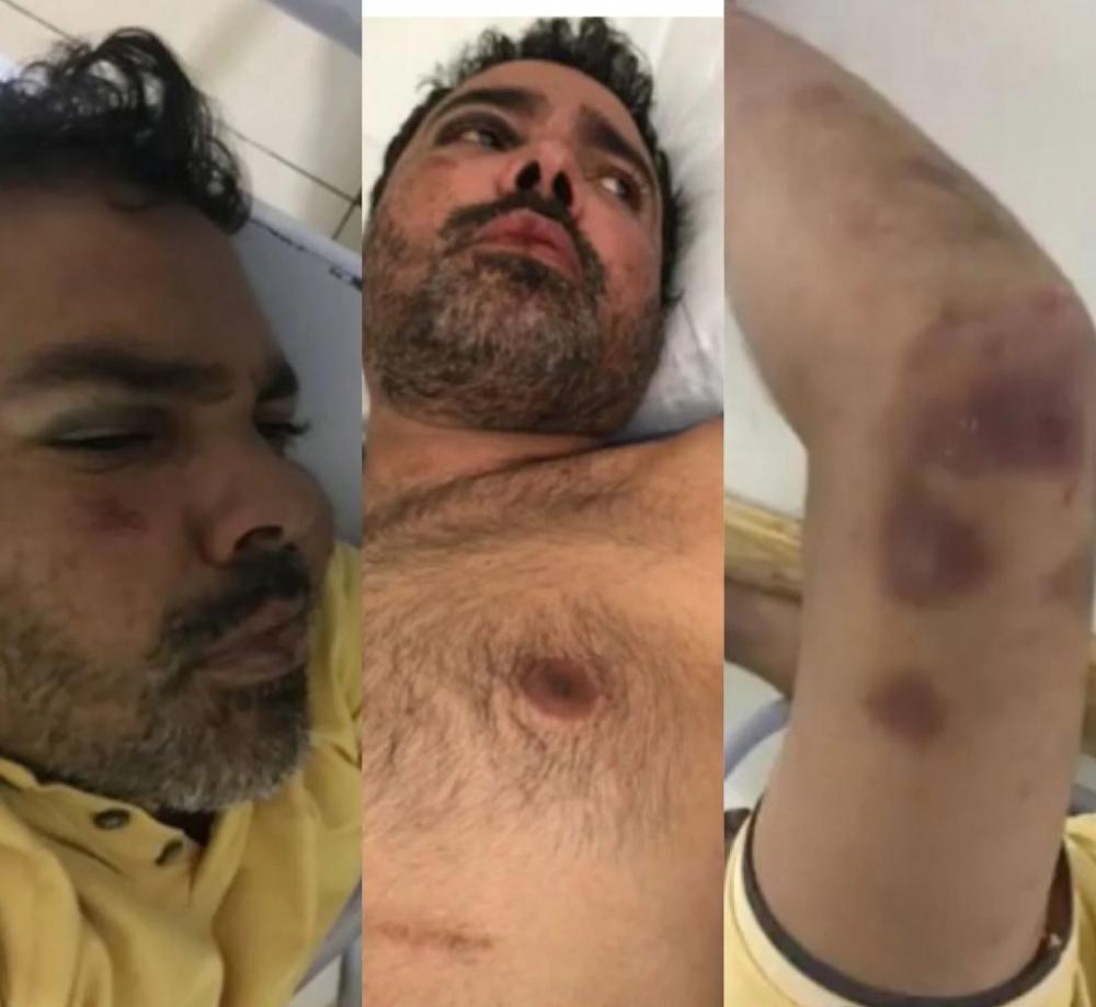 Após ser preso, dentista é achado inconsciente e com sinais de agressão no Piauí
