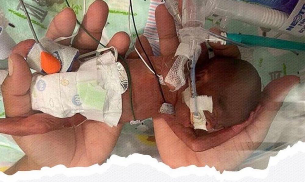 Bebê que nasceu com 5 meses e com 1% de chance de vida sobrevive após oração da mãe; veja!