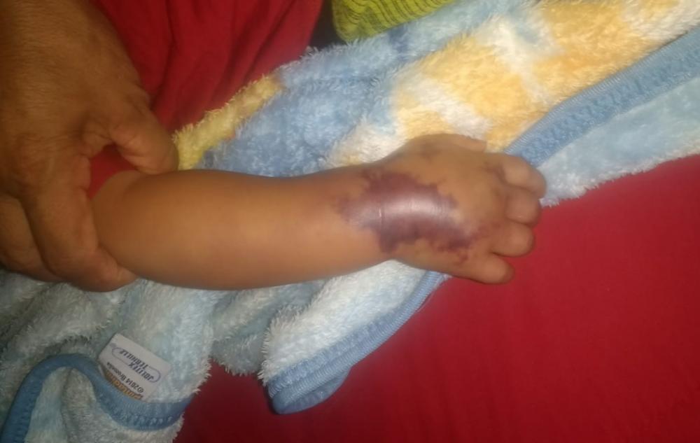 Bebê fica com veia do braço roxa e morre após internação em hospital no Piauí