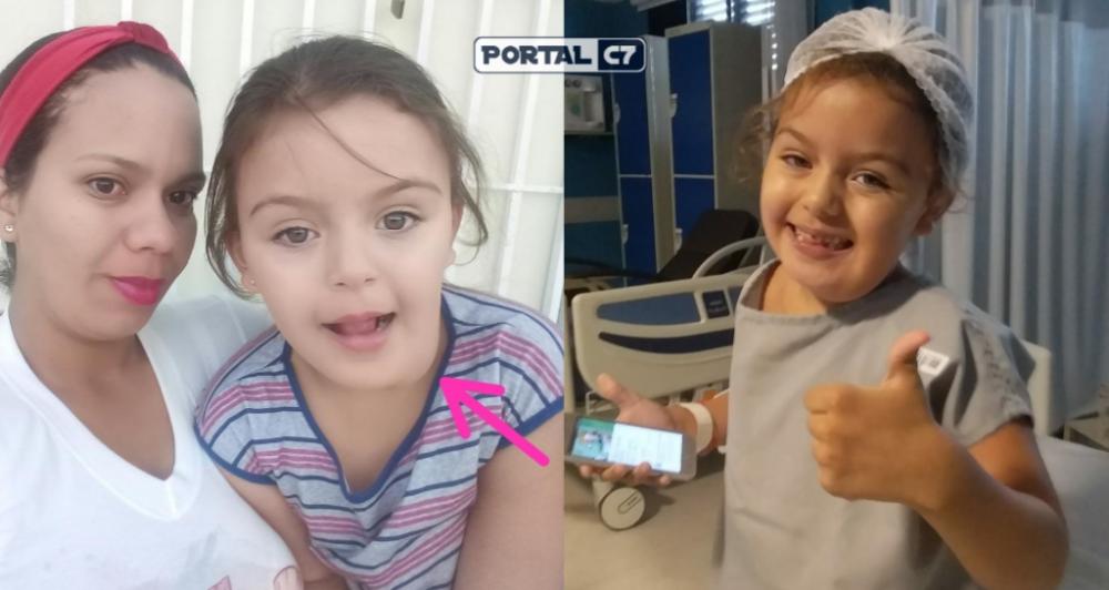 Criança com necessidades especiais e doença rara luta há mais de 1 ano por cirurgia no Piauí