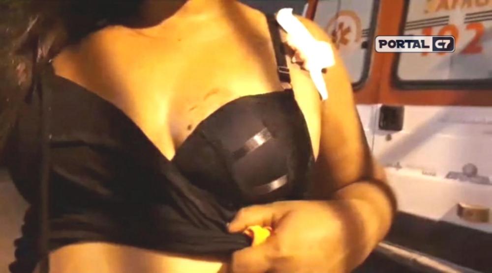 Mulher é 'furada' com estilete durante briga na cidade de Floriano