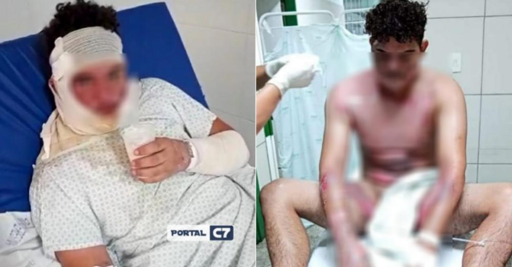 Família alega que menor foi estuprada por rapaz agredido com água fervente no Piauí 
