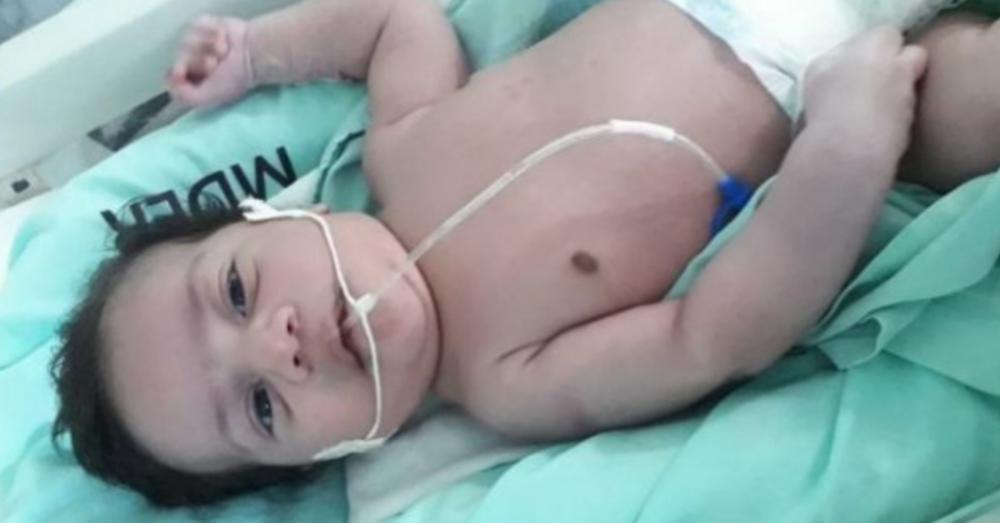 Bebê de Angical precisa de ajuda para realizar cirurgia cardíaca fora do Piauí