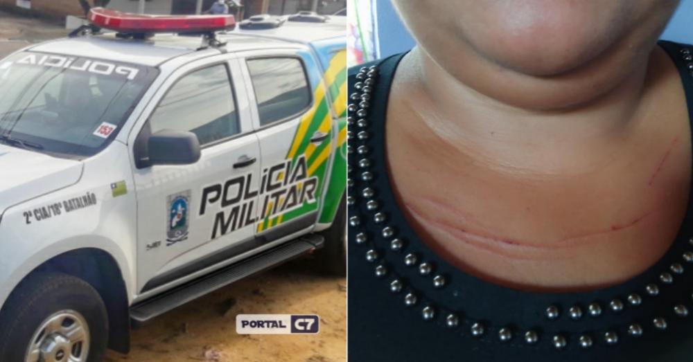Mulher de São Francisco do Maranhão fica ferida após ser assaltada em Amarante